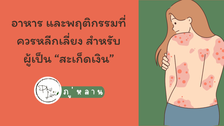 ภู่หลาน ชวนคุยเรื่อง สำหรับผู้เป็น “สะเก็ดเงิน”