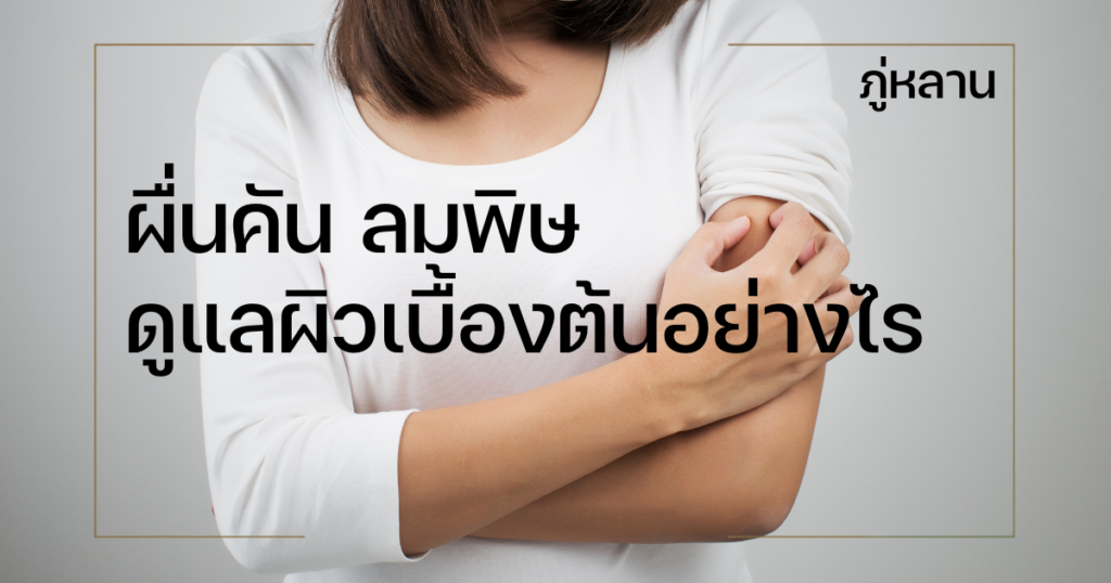 ผื่นคัน ลมพิษ เกิดจากอะไร ดูแลผิวเบื้องต้นอย่างไรให้ปลอดภัย