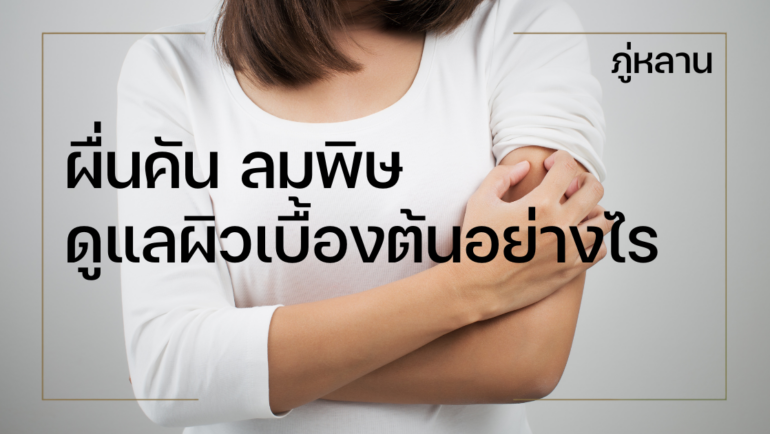 ผื่นคัน ลมพิษ เกิดจากอะไร ดูแลผิวเบื้องต้นอย่างไรให้ปลอดภัย